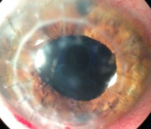 Cirugía reconstructiva ocular