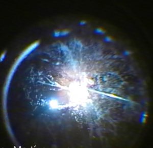 miodesopsias