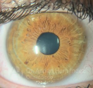 OJO COLOR AVELLANA