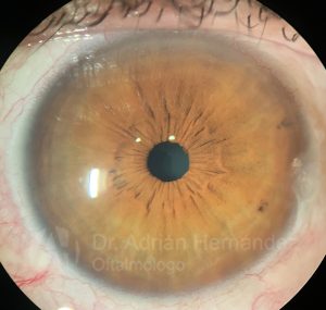 OJO COLOR MARRON