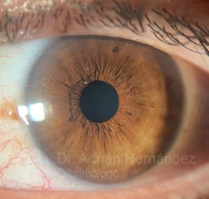 OJO COLOR MARRON
