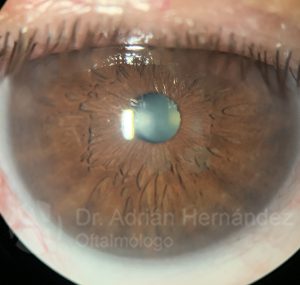 OJO COLOR MARRON